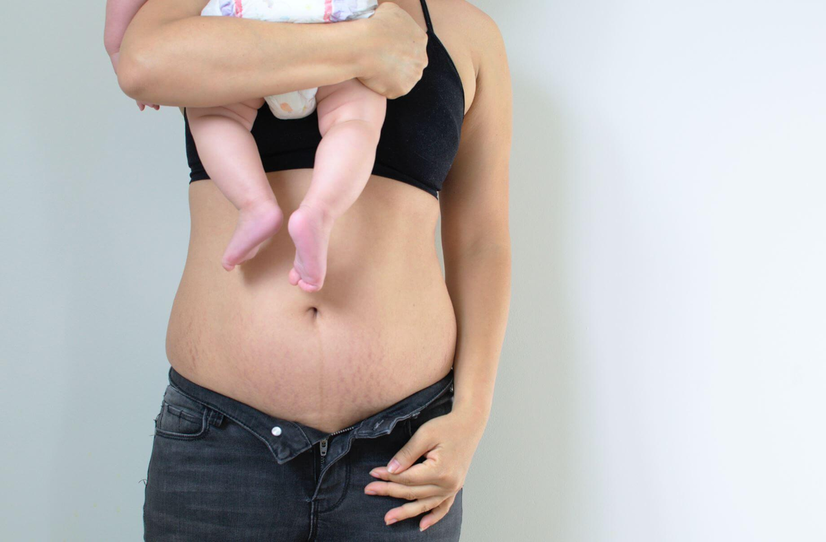 Набор веса после рождения ребенка: причины и способы решения